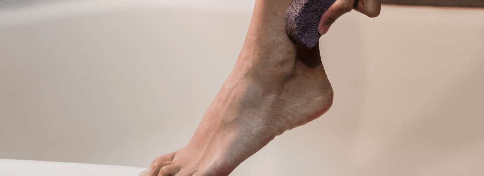 Moisturize diabetic feet